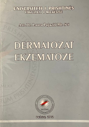 Fotoja e Dermatozat Ekzematoze - Laura Pajaziti