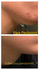 Fotoja e Peeling eksfoliues për fytyrë The Ordinary AHA 30% + BHA 2%, 30ml, Picture 2