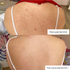Fotoja e Peeling eksfoliues për fytyrë The Ordinary AHA 30% + BHA 2%, 30ml, Picture 5