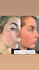 Fotoja e Serum për fytyrë kundër rrudhave The Ordinary Retinol 0.2% in Squalane, 30ml, Picture 3