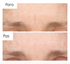 Fotoja e Serum për fytyrë kundër rrudhave The Ordinary Retinol 0.5% in Squalane, 30ml, Picture 2