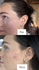 Fotoja e Serum kundër rrudhave The Ordinary Retinol 1% in Squalane, 30ml, Picture 4