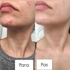 Fotoja e Serum kundër akneve The Ordinary Salicylic Acid 2%, 30ml, Picture 4