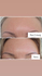Fotoja e Serum për rrudha The Ordinary Argireline Solution 10%, 30ml, Picture 3