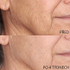Fotoja e Krem hidratues për fytyrë Perricone MD SPF 30 High Potency Classics, 59 ml, Picture 3