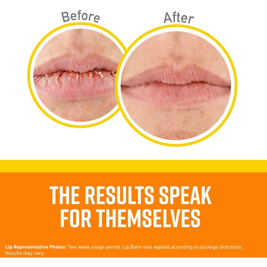 Balsam për buzë O'KEEFFE'S Lip Repair SPF 4.2g