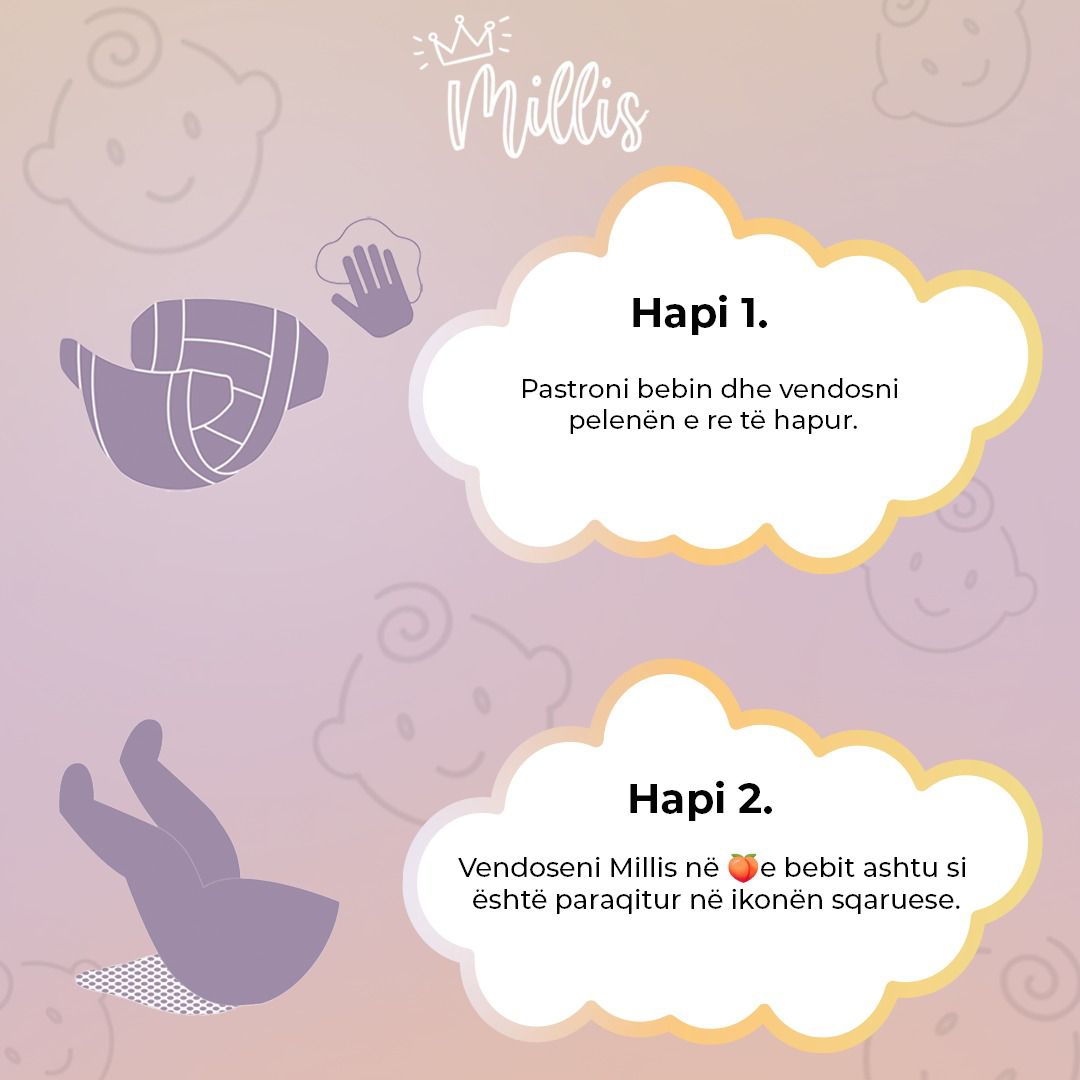 Peceta Magjike Millis, 25 copë