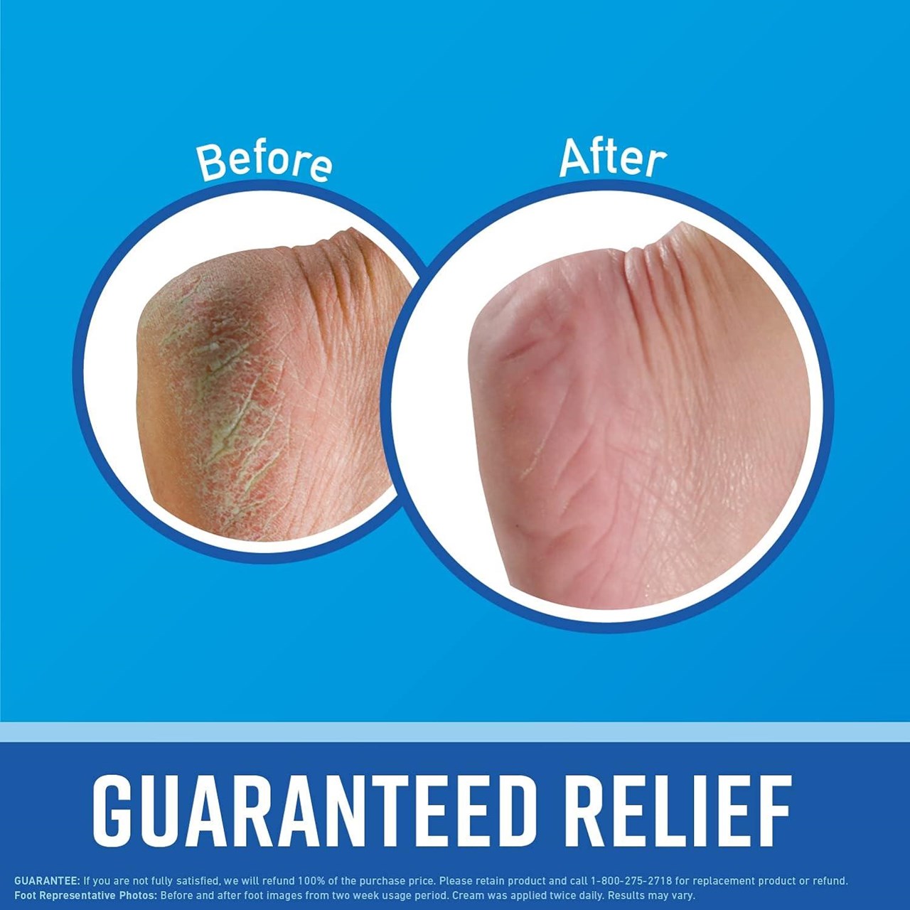 Krem për këmbë O'KEEFFE'S Healthy Feet, Pomadë 91g