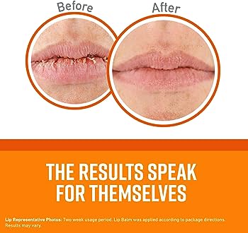 Balsam për buzë O'KEEFFE'S Lip Repair, Pa shije 4.2g