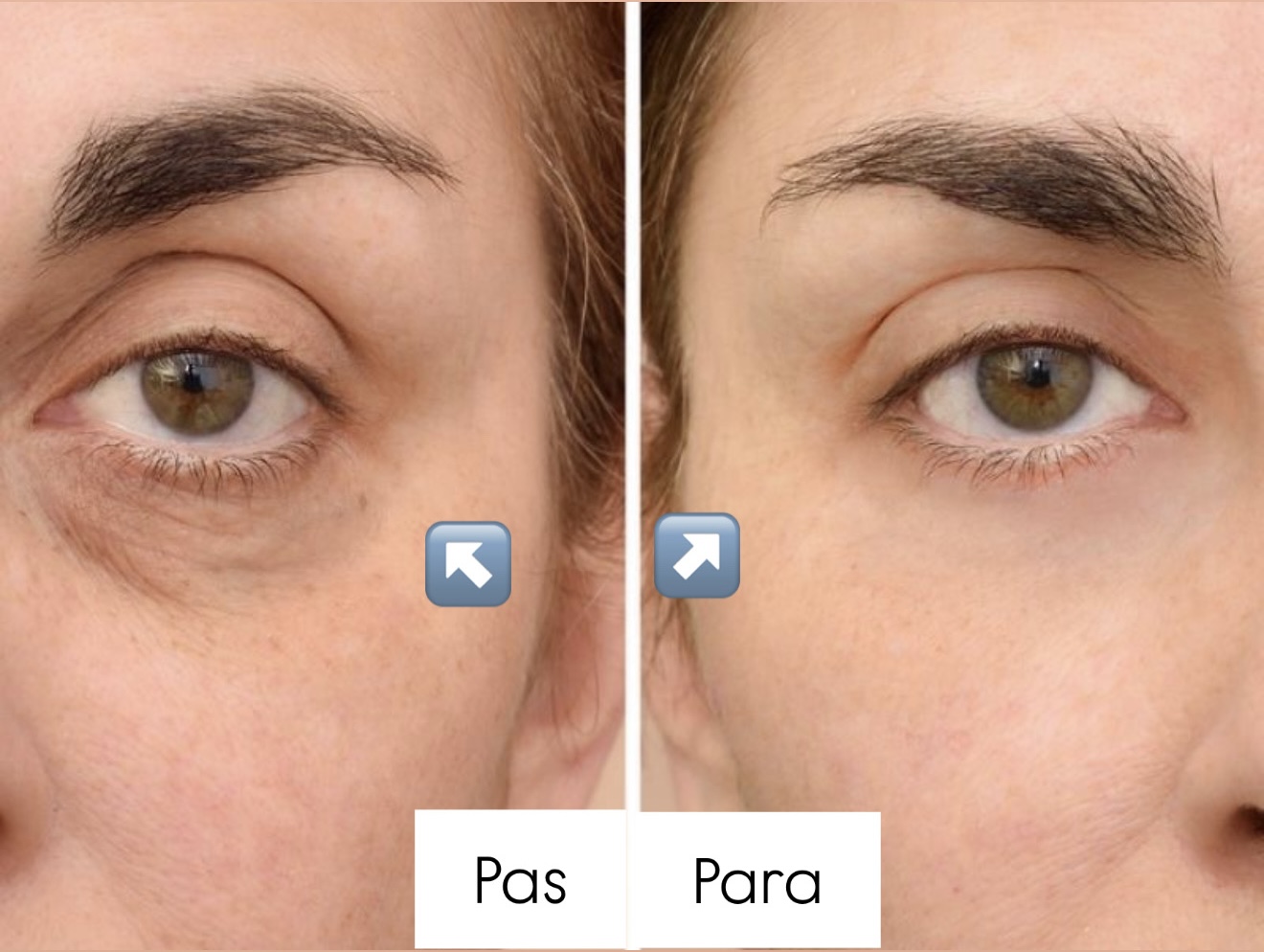 Serum për sy The Ordinary Caffeine Solution 5% + EGCG, 30ml